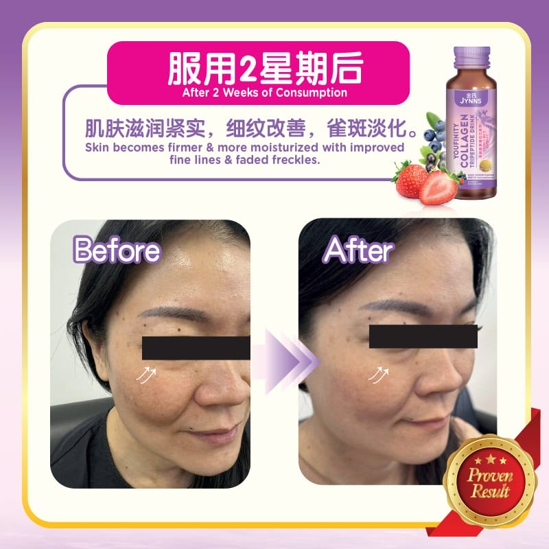 CL02 JYNNS Youfinity Collagen Tripeptides Drink Combo Set 金氏冻龄胶原蛋白三肽饮 50ml x 18 Bottle